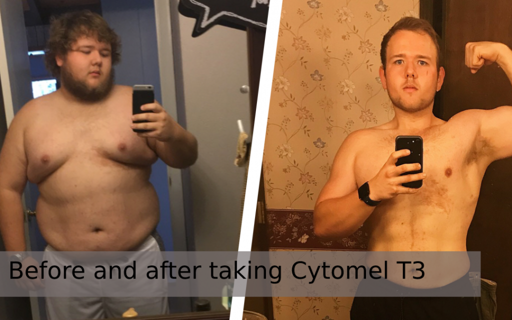 Before and after taking Cytomel T3